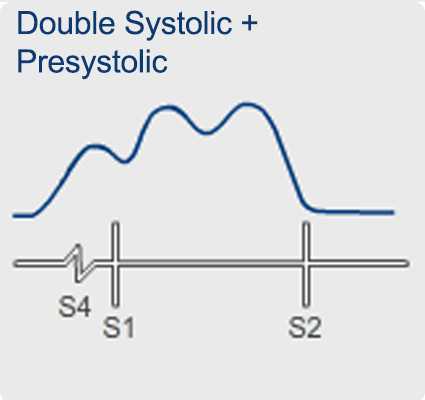 Hyperkinetic