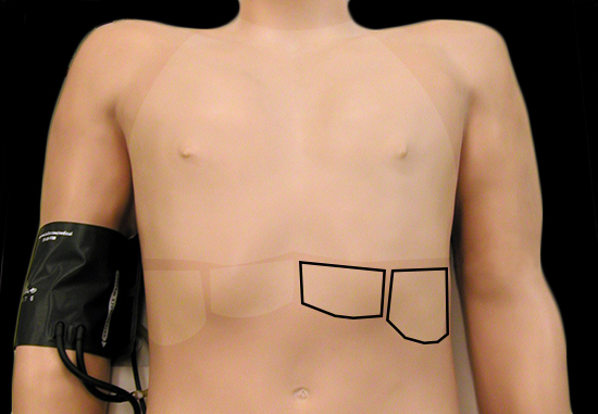 auscultation areas review