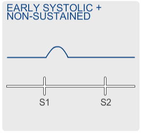 Hyperkinetic