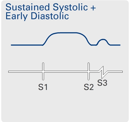 Hyperkinetic