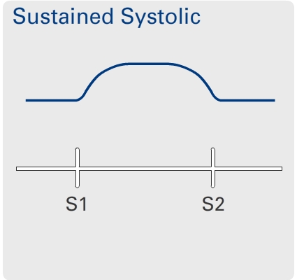 Hyperkinetic