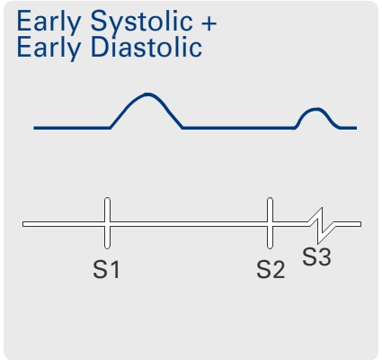 Hyperkinetic