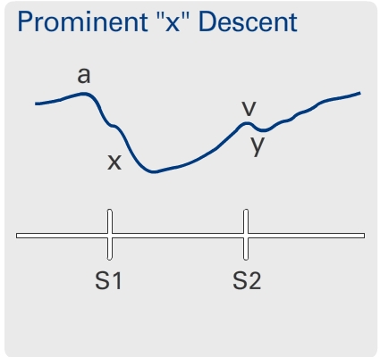 Hyperkinetic