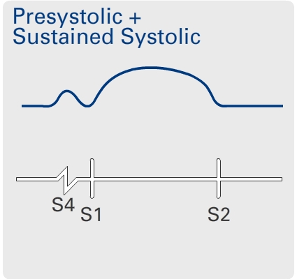 Presystolic + sustained systolic