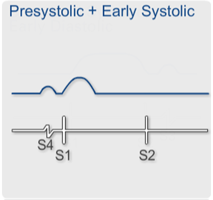 Presystolic + Early Systolic